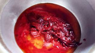 photo-01